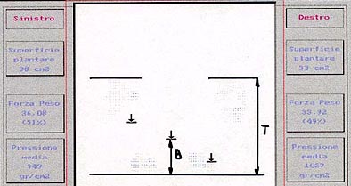 FIG. 51