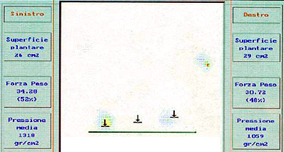 FIG. 54A