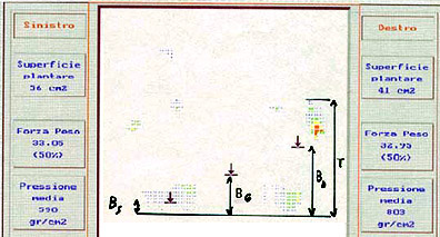 FIG. 55A