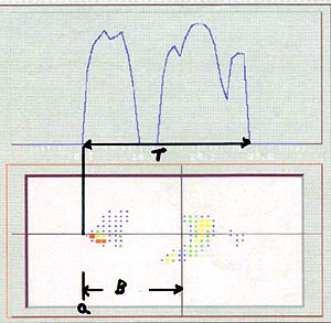 FIG. 55C